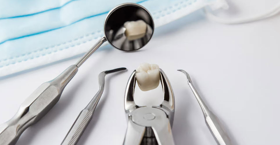 tooth extraction 